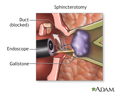 common bile duct diagram. Distal+common+ile+duct+